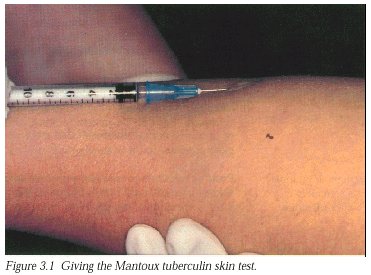 normal negative tb test pictures